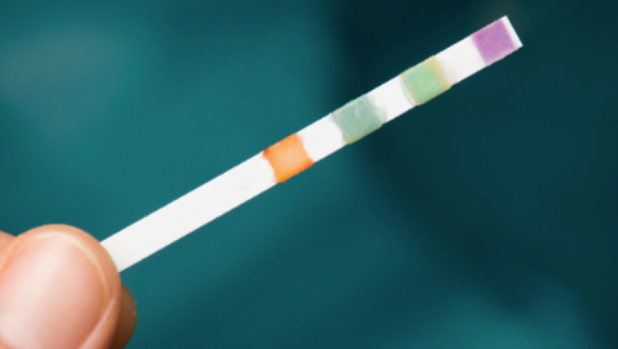 Water Chemistry Test